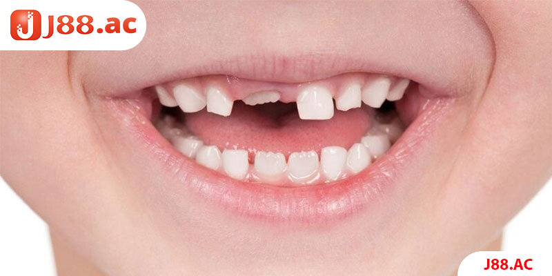 Giấc mộng thấy răng rụng có ý nghĩa gì?